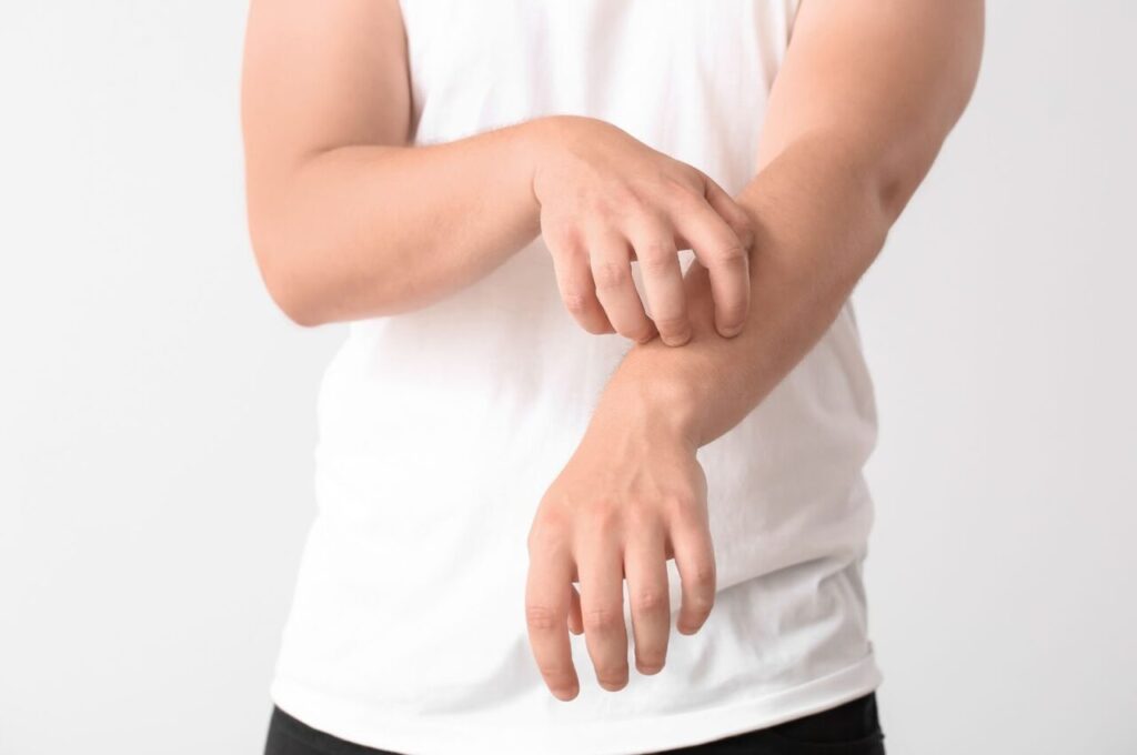 肝硬変によるかゆみで腕を書いている人