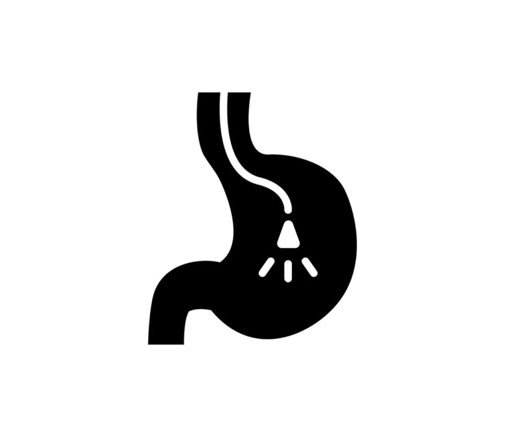 胃カメラ検査のイメージイラスト