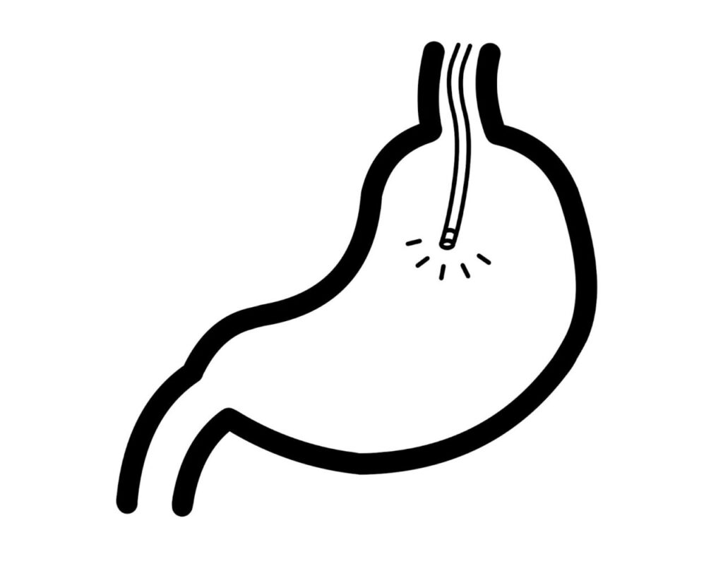 胃カメラ検査のイメージイラスト