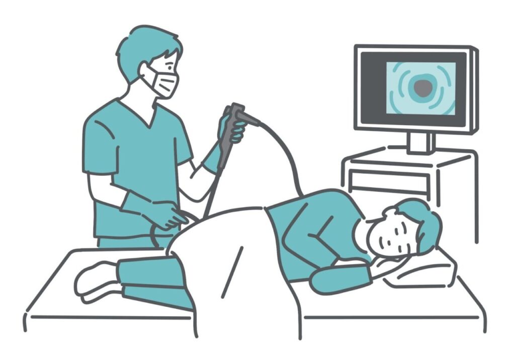 大腸カメラ検査中のイラスト