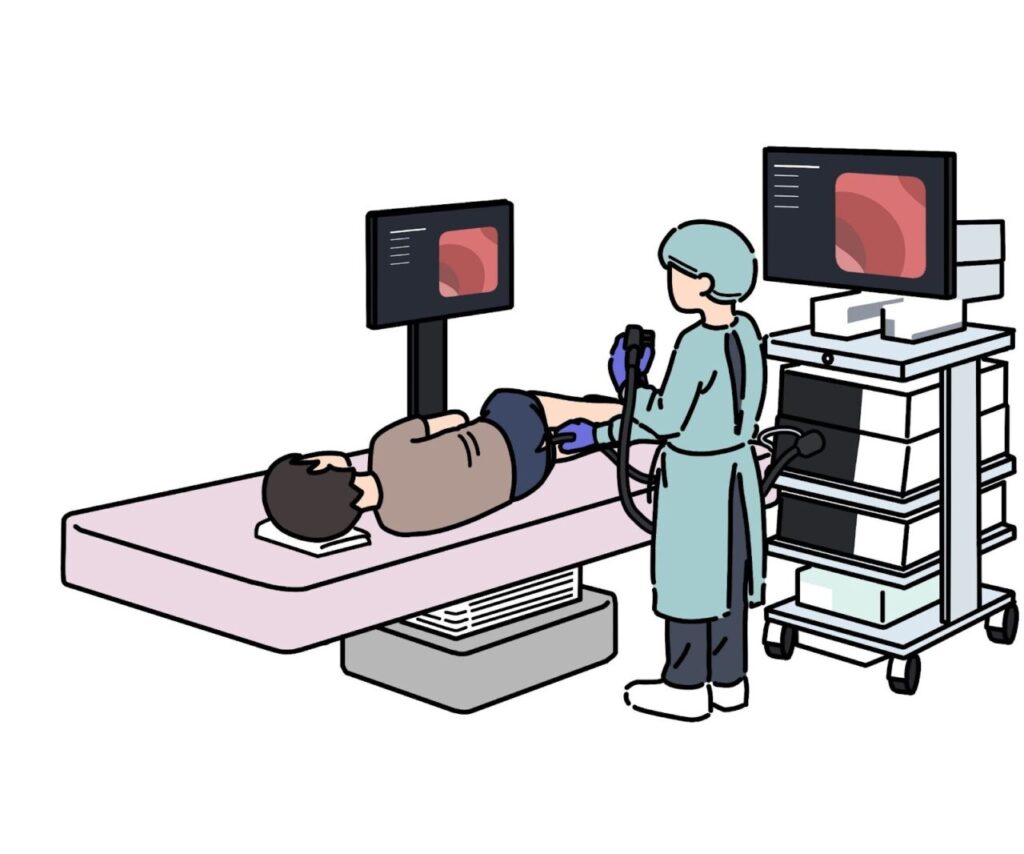 大腸カメラ検査中のイラスト
