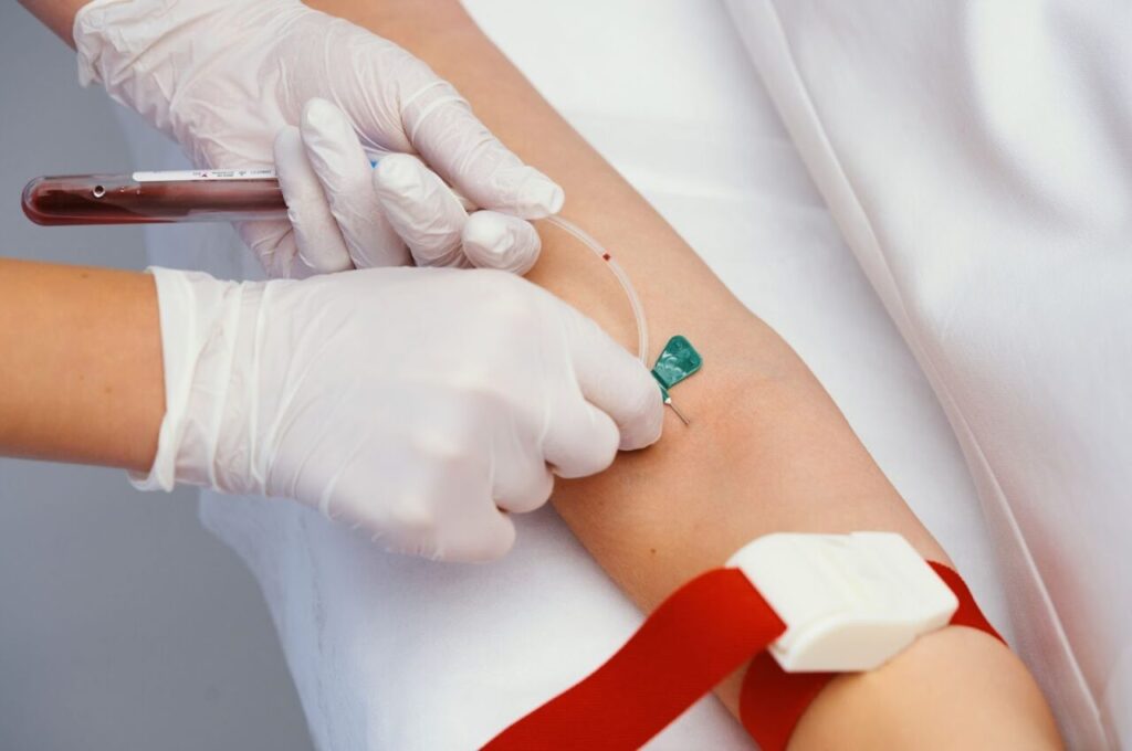 血液検査を受けている人の腕